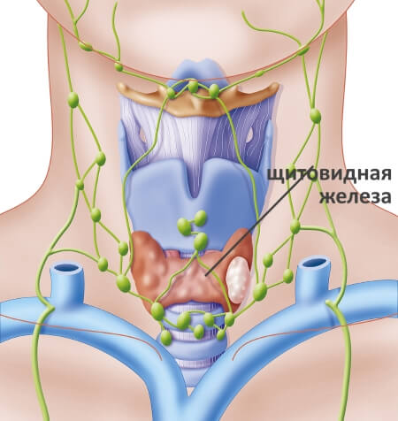 Болезни щитовидной железы у женщин тиреотоксикоз