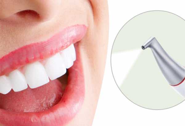 Что такое чистка зубов Air Flow?
